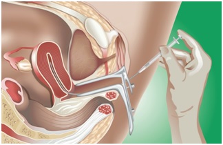 Antenatal Care