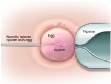 Antenatal Care